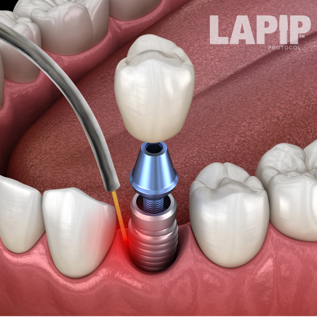 Dentist in Naples